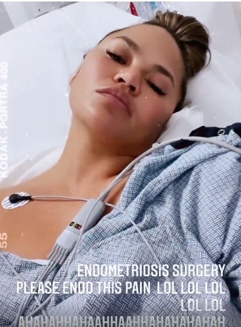 Криси Тийгън се подложи на операция заради ендометриоза